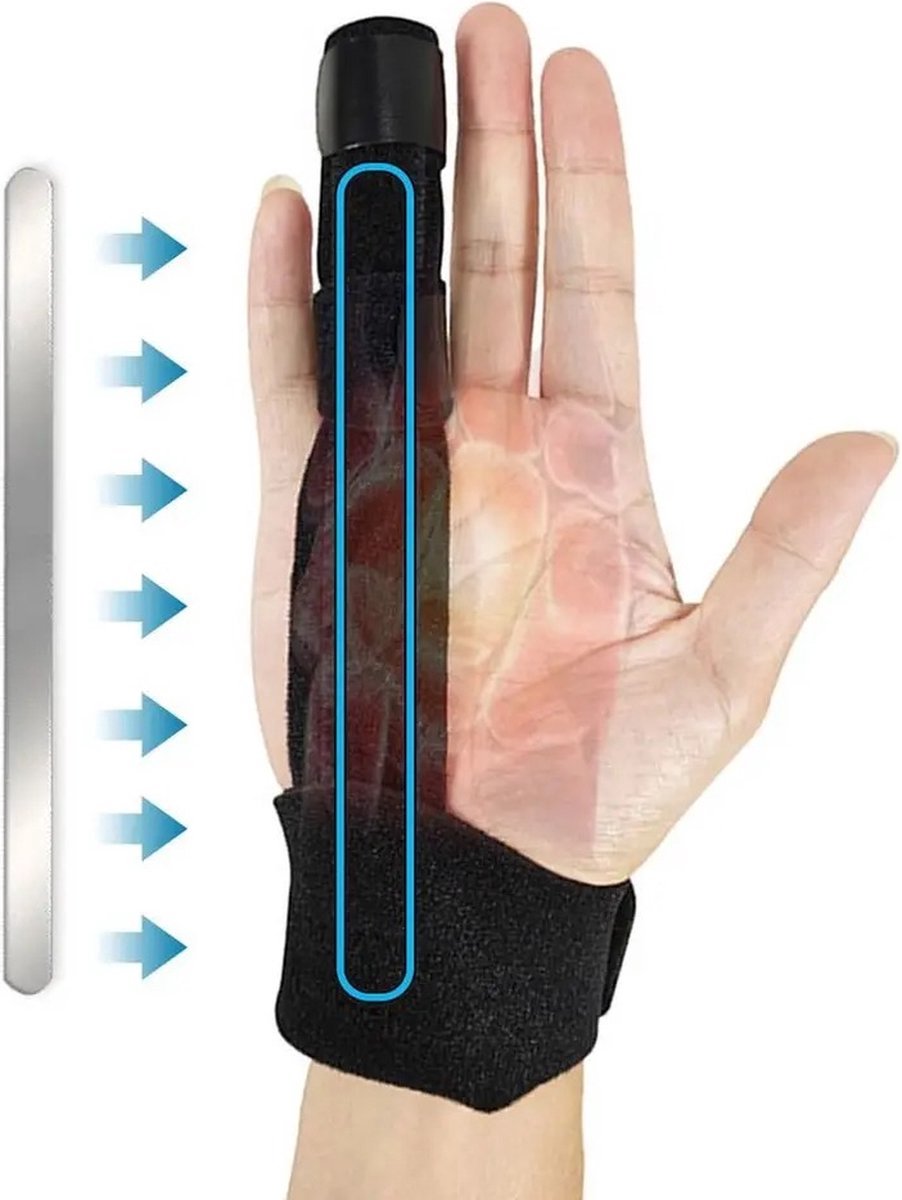 Dupuytren brace