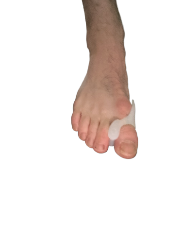 Teenspreiders - Hallux valgus