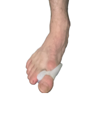 Teenspreiders - Hallux valgus