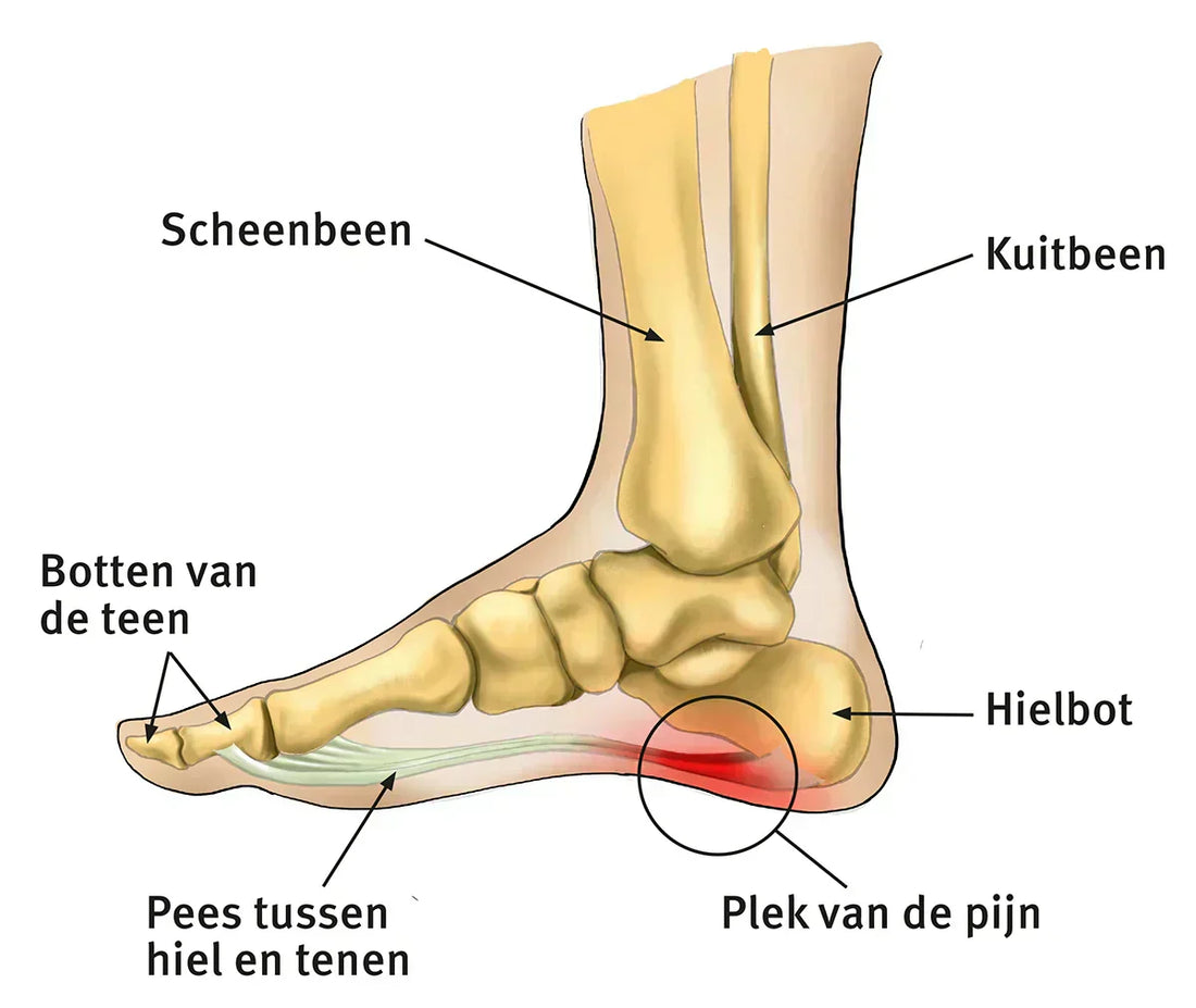 Hielspoor klachten, wat kan je hiermee? 