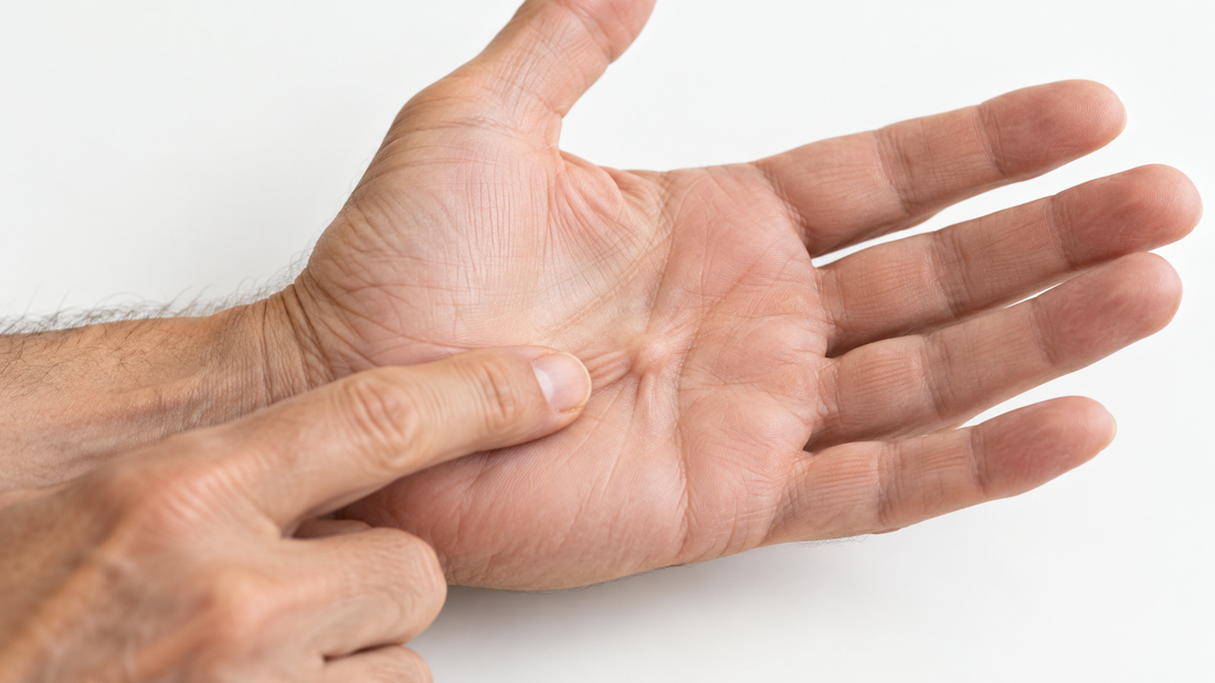 Hand met kromstand van de vingers bij de ziekte van Dupuytren