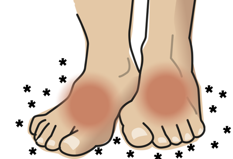 Wat is Neuropathie en Hoe Kun Je Het Thuis Behandelen?