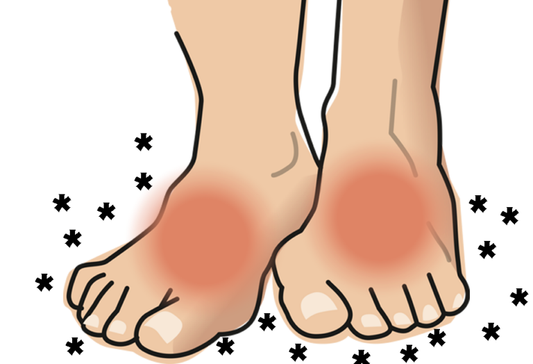 Wat is Neuropathie en Hoe Kun Je Het Thuis Behandelen?